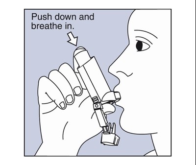 F (Patient Package Insert 6)